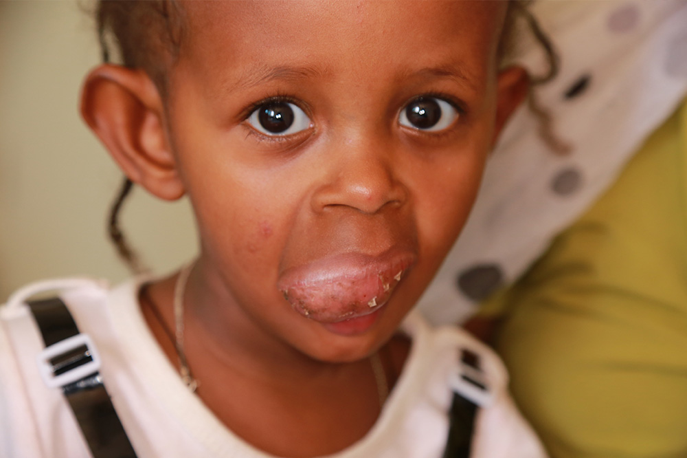 ETHIOPIA HEALTHAID, ADAMA, ETHIOPIA