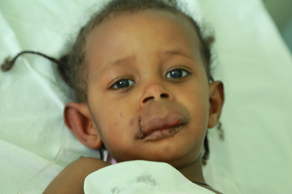 ETHIOPIA HEALTHAID, ADAMA, ETHIOPIA